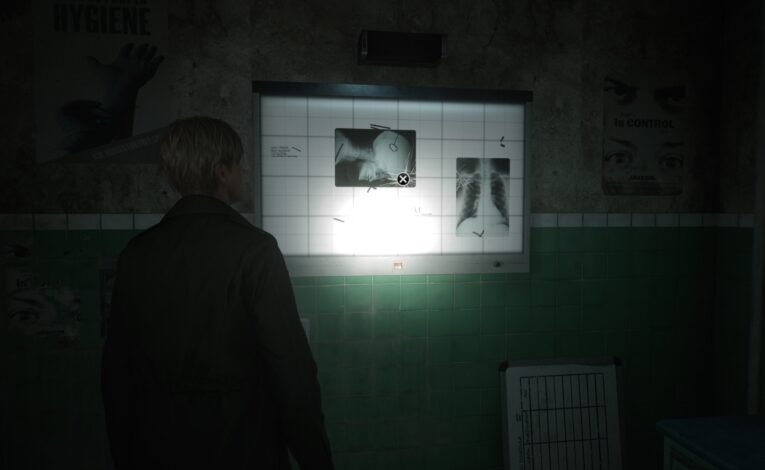 Röntgen-Puzzle - Silent Hill 2 (c) Konami, Bloober Team